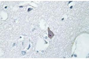 Image no. 2 for anti-Opioid Receptor, mu 1 (OPRM1) antibody (ABIN317766) (Mu Opioid Receptor 1 anticorps)