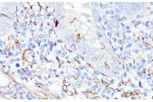 Immunohistochemistry of paraffin-embedded Human appendix using CCDC6 Polyclonal Antibody at dilution of 1:100 (40x lens).