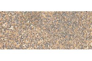 Immunohistochemistry of paraffin-embedded Human tonsil tissue using PDAP1 Polyclonal Antibody at dilution of 1:50(x200)