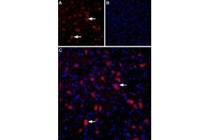 Expression of kainate receptor GluK4 in rat cerebellar deep nuclei - Immunohistochemical staining of immersion-fixed, free floating rat brain frozen sections using Anti-GRIK4 (KA1) (extracellular) Antibody (ABIN7043240, ABIN7044380 and ABIN7044381), (1:100).