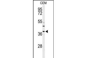 RNASEH2B antibody  (AA 130-157)