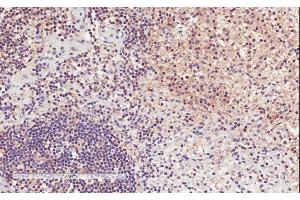 ABIN571017 (2µg/ml) staining of paraffin embedded Human Lymph Node. (ITGAL anticorps  (Internal Region))