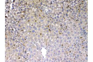 PSAT1 was detected in paraffin-embedded sections of mouse liver tissues using rabbit anti- PSAT1 Antigen Affinity purified polyclonal antibody (Catalog # ) at 1 ? (PSAT1 anticorps  (AA 276-370))