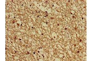 Immunohistochemistry of paraffin-embedded human brain tissue using ABIN7154707 at dilution of 1:100