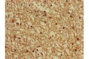 Immunohistochemistry of paraffin-embedded human brain tissue using ABIN7154707 at dilution of 1:100 (GNAS anticorps  (AA 1-394))