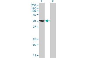 Western Blot analysis of CAMK2D expression in transfected 293T cell line by CAMK2D monoclonal antibody (M02), clone 1A8. (CAMK2D anticorps  (AA 301-410))