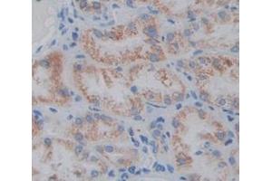 IHC-P analysis of Human Tissue, with DAB staining. (Angiopoietin 1 anticorps  (AA 284-452))