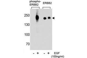 Western blot analysis of extracts from A431 cells, untreated or treated with EGF (100ng/ml), using p-ERBB2 antibody (left) or nonphos Ab (right)