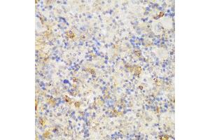 Immunohistochemistry of paraffin-embedded mouse spleen using GCC2 antibody (ABIN6130422, ABIN6141007, ABIN6141008 and ABIN6217941) at dilution of 1:150 (40x lens).