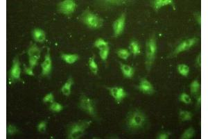 Detection of MPP2 in A549 cells using Polyclonal Antibody to Membrane Protein, Palmitoylated 2 (MPP2)