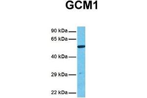 Host:  Rabbit  Target Name:  GCM1  Sample Tissue:  Human 293T  Antibody Dilution:  1.