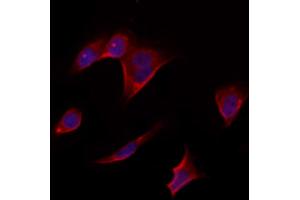 ABIN6264846 and ABIN6273312 staining Hela by IF/ICC. (RPS14 anticorps  (Internal Region))