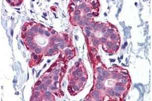 Human Breast: Formalin-Fixed, Paraffin-Embedded (FFPE)