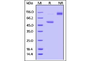 Mouse CD40 Ligand / TNFSF5, Fc Tag on SDS-PAGE under reducing (R) and no-reducing (NR) conditions.