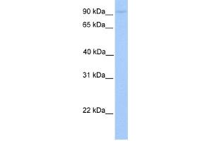 WB Suggested Anti-AGBL5 Antibody Titration: 0. (AGBL5 anticorps  (C-Term))