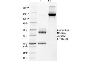 SDS-PAGE Analysis Purified NKX2. (Nkx2-2 anticorps  (AA 1-119))