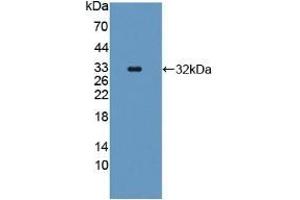 Detection of Recombinant CASP11, Human using Polyclonal Antibody to Protein SCAF11 (SCAF11) (SCAF11 anticorps  (AA 944-1148))