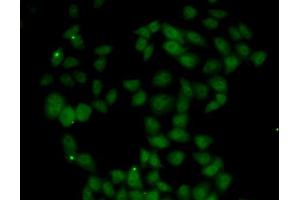 Immunofluorescence analysis of U2OS cells using FGF14 antibody (ABIN5973959). (FGF14 anticorps)