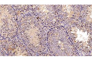 Detection of C3 Convertase in Mouse Testis Tissue using Polyclonal Antibody to Complement C3 Convertase (C3 Convertase) (Complement C3 Convertase anticorps)