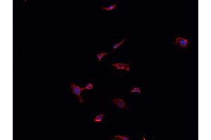 ABIN6268891 staining LOVO cells by IF/ICC. (FAP anticorps  (Internal Region))