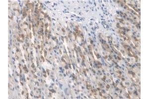 Detection of ARNTL in Rat Stomach Tissue using Polyclonal Antibody to Aryl Hydrocarbon Receptor Nuclear Translocator Like Protein (ARNTL)