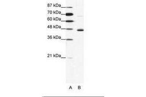 Image no. 1 for anti-Neuronal Differentiation 1 (NEUROD1) (N-Term) antibody (ABIN202333) (NEUROD1 anticorps  (N-Term))
