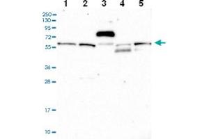 Western blot analysis of Lane 1: RT-4 Lane 2: U-251 MG Lane 3: Human Plasma Lane 4: Liver Lane 5: Tonsil with C15orf44 polyclonal antibody ( Cat # PAB28001 ) at 1:100 - 1:250 dilution. (VWA9 anticorps)