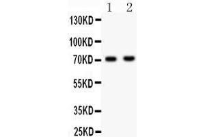 Anti- NUMB Picoband antibody, Western blotting All lanes: Anti NUMB  at 0. (NUMB anticorps  (N-Term))