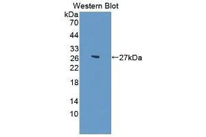 Detection of Recombinant CACT, Rat using Polyclonal Antibody to Solute Carrier Family 25 Member 20 (SLC25A20) (SLC25A20 anticorps  (AA 1-211))