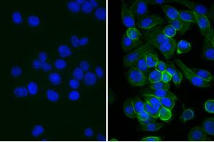 Human pancreatic carcinoma cell line MIA PaCa-2 was stained with Mouse Anti-Human CD44-UNLB, and DAPI. (Lapin anti-Souris IgG (Heavy & Light Chain) Anticorps)