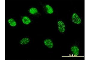 Immunofluorescence of monoclonal antibody to MSH6 on HeLa cell. (MSH6 anticorps  (AA 931-1030))