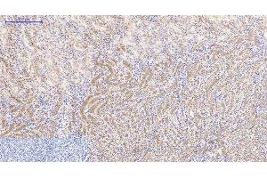 Immunohistochemistry of paraffin-embedded Mouse kidney tissue using Catenin beta Monoclonal Antibody at dilution of 1:200.