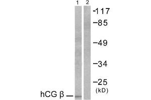Western Blotting (WB) image for anti-HCG beta (C-Term) antibody (ABIN1848592) (HCG beta anticorps  (C-Term))