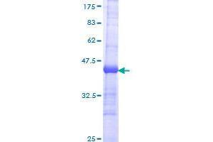 Image no. 1 for Ena-Vasodilator Stimulated Phosphoprotein (EVL) (AA 309-418) protein (GST tag) (ABIN1353203)