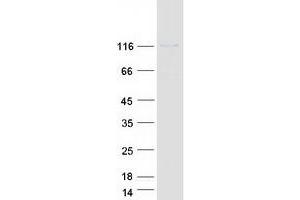 Validation with Western Blot
