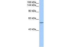 WB Suggested Anti-DLC1 Antibody Titration: 0. (DLC1 anticorps  (C-Term))