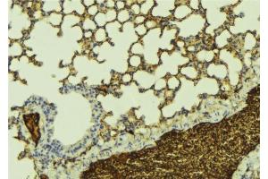 ABIN6277156 at 1/100 staining Mouse lung tissue by IHC-P.