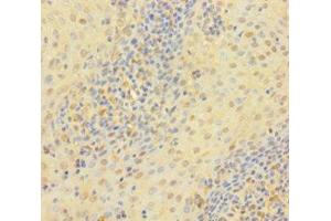 Immunohistochemistry of paraffin-embedded human tonsil tissue using ABIN7172118 at dilution of 1:100 (Thymidine Phosphorylase anticorps  (AA 13-254))