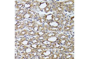 Immunohistochemistry of paraffin-embedded mouse kidney using D antibody (ABIN7266712) at dilution of 1:100 (40x lens).
