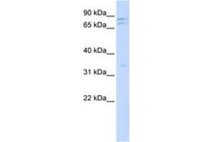 Image no. 1 for anti-NIMA (Never In Mitosis Gene A)-Related Kinase 11 (NEK11) (AA 504-553) antibody (ABIN6743500) (NEK11 anticorps  (AA 504-553))