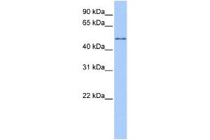 WB Suggested Anti-CCT8L2 Antibody Titration:  0.