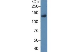Detection of LIFR in Rat Placenta lysate using Polyclonal Antibody to Leukemia Inhibitory Factor Receptor (LIFR) (LIFR anticorps  (AA 642-791))