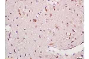 Formalin-fixed and paraffin embedded rat brain labeled with Anti-phospho-MAPKAPK5(Thr182) Polyclonal Antibody, Unconjugated (ABIN710546) at 1:200, followed by conjugation to the secondary antibody and DAB staining