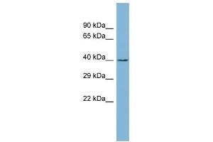 CK1 gamma 2 antibody used at 1 ug/ml to detect target protein. (Casein Kinase 1 gamma 2 anticorps  (Middle Region))