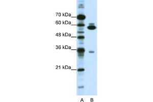 WB Suggested Anti-ZNF446 Antibody Titration:  1. (ZNF446 anticorps  (C-Term))