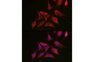 Immunofluorescence analysis of NIH/3T3 cells using NRAS Rabbit pAb (ABIN7267532) at dilution of 1:100 (40x lens).