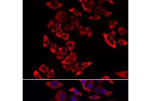 Immunofluorescence analysis of MCF-7 cells using RPL9 Polyclonal Antibody