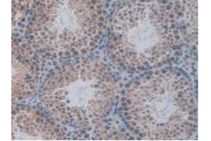 IHC-P analysis of Mouse Testis Tissue, with DAB staining. (TCF20 anticorps  (AA 1871-1965))