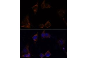 Immunofluorescence analysis of NIH/3T3 cells using IL13R antibody (ABIN7267987) at dilution of 1:100. (IL13RA2 anticorps)