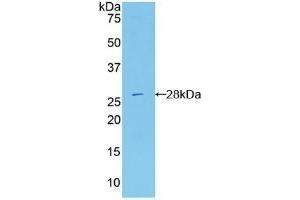Detection of Recombinant RIG1, Mouse using Polyclonal Antibody to Probable ATP-dependent RNA Helicase DDX58 (DDX58) (DDX58 anticorps  (AA 1-211))